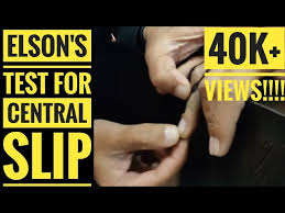 Image result for Elson Extensor Tendon Test