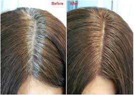 The enzymatic extract from ecklonia cava may potentially be used as a treatment for hair loss. Qoo10 Bringing The Best To You