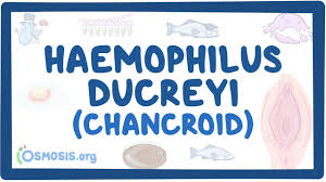 Image result for chancroid