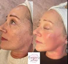 This treatment will work