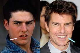 Minority report is a 2002 american science fiction action film directed by steven spielberg, starring tom cruise, and loosely based on the 1956 short story the minority report by philip k. Tom Cruise Teeth Big 102 1 Kybg Fm