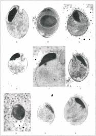 Image result for Balantoides Coli