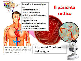 Sometimes incorrectly called blood poisoning, sepsis is the body's often deadly response to infection or injury. La Sepsi O Setticemia E Lo Shock Settico