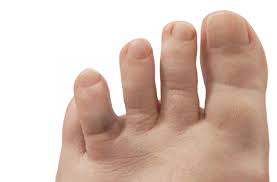 The injured toe should be examined every day. Broken Toe Symptoms Pictures And Treatment