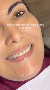 photo‎‏ على Instagram من ‏‎DENTISTA