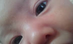 Cor Do Olho Marco De 2019 Babycenter