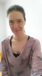 Para caminhar depois do AVC, cada aspecto conta: , Quando iniciou a  reabilitação , Intensidade e especialização do tratamento , Condição  nutricional, Manejo das emoções e comportamento da pessoa., ...