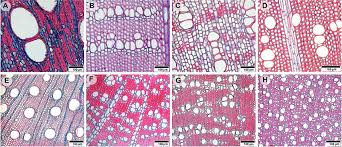 Other cells are comprived with a lipid called lignin. Frontiers Parenchyma Abundance In Wood Of Evergreen Trees Varies Independently Of Nutrients Plant Science