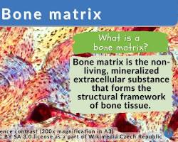 Image of Bone matrix composition diagram