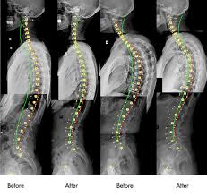 Image result for Posture