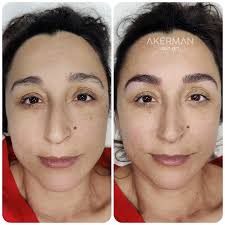 Carolina Akerman SKIN ART (@akermanskinart) · Torremolinos-Málaga