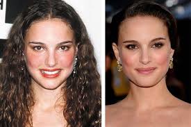 Natalie Portman Plastic Surgery Has She Had A Nose Job Nose Job Plastic Surgery Natalie Portman