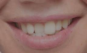 Maybe you would like to learn more about one of these? Cosmetic Dentistry Dental Associates