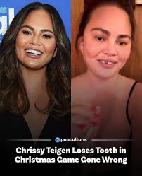 This is what moms do for their kids, so you can think you grew a candy  cane,” said Teigen. “I was trying to create magic — now I have no tooth."  See