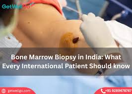 Image result for Bone Marrow Exam