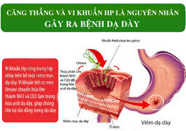 But you can keep heartburn in check with the right treatment, like a medicine or lifestyle change. Chia Sáº» Vá» Qua Trinh Chá»¯a Trá»‹ Bá»‡nh Ä'au Dáº¡ Day Cá»§a Chá»‹ Nguyá»…n Má»¹ Lá»‡ Sieu Nghá»‡
