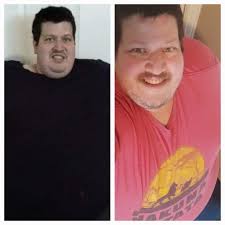 What's a noticeable difference 7 days post-op?