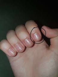 Weitere ideen zu nagelideen, nageldesign, nägel selber machen. Zu Kurze Nagel Furs Nagelstudio Nagelkauen Acrylnagel