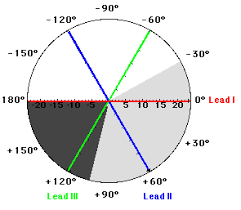 Ekg Tutorial The Mean Electrical Axis