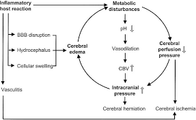 Meningitis is caused by the bacteria neisseria meningitidis (known as meningococcal meningitis). Pdf Pathophysiology Of Bacterial Meningitis Mechanism S Of Neuronal Injury Semantic Scholar