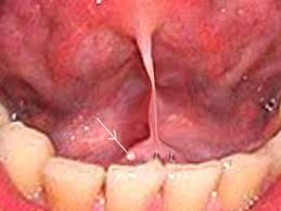 Image result for Submandibular Exam