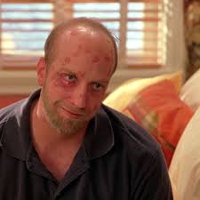 Mitesser entfernen: Wie gut funktioniert ein Porensauger gegen Pickel und  Unreinheiten? Unser Test