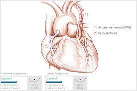 We are super excited to announce that meagan will be joining our team in the fall. Herz Gefasschirurgie