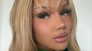 Shirin David offen: Sie steht zu ihren Beauty-Eingriffen