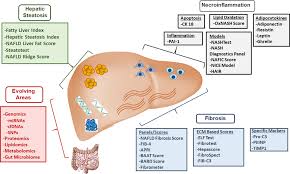 Image result for BARD Score