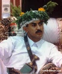 أم أحمد علي عبدالله صالح. ØªÙ…Ù‡ÙŠØ¯Ø§ Ù„Ù„Ø¹Ù‚ÙˆØ¨Ø§Øª Ø§Ù‚Ø§Ù„Ø© Ø§Ù„Ø³ÙÙŠØ± Ø£Ø­Ù…Ø¯ Ø¹Ù„ÙŠ Ø¹Ø¨Ø¯Ø§Ù„Ù„Ù‡ ØµØ§Ù„Ø­ ÙŠÙ…Ù† ÙÙˆÙŠØ³ Ù„Ù„Ø£Ù†Ø¨Ø§Ø¡