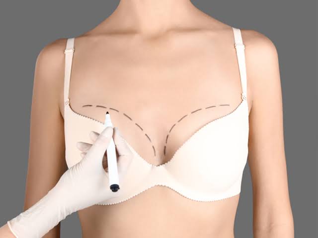 Breast Augmentation Dubai | Cost, Recovery & Consultation