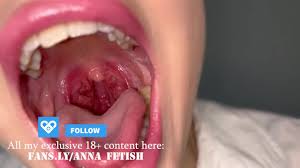 I let you hang on my uvula and cum in my mouth with your tiny cum before I  swallow you