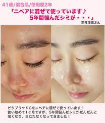 芸能人 モデルの必需品 シミ シワ 毛穴をなくす最強美白パウダーって lecoviqinfo com 顔 毛穴 美白 毛穴