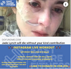 Jade Lynch is a 21-year-old girl from Co Mayo. Jades has been fighting  multiple debilitating illnesses since the tender age of fourteen these  diseases which include Ehlers Danlos Syndrome, Pots, SVT and