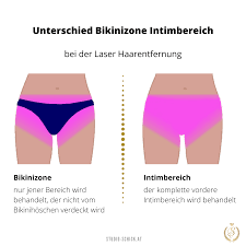 Eine dauerhafte haarentfernung per laser, die den traum von glatter, haarfreier haut permanent möglich macht. Bikinizone Lasern 2021 Alles Was Sie Wissen Mussen