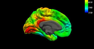 Seine hauptaufgabe besteht darin, als selektiver (semipermeabler) filter zu wirken, der nur bestimmte moleküle durchlässt, während andere zur richtigen zeit blockiert werden. Was Ist Die Blut Hirn Schranke Brain Metabolics Nahrungserganzung Fur Dein Gehirn
