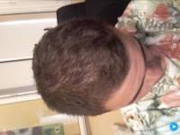 His balding head ex. fr. Est Ce Que Jai Un Debut De Calvitie Sur Le Dessus Du Crane
