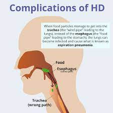 Complications Of Huntington S Disease Hopes Huntington S Disease Information