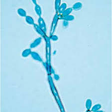Dermatitidis, phialophora verrucosa, cladosporium carrionii, rhinochdiella aquaspersa, exophiala jeanselmei. Fonsecaea Pedrosoi Colony On Sga Medium After 14 Days Of Incubation Download Scientific Diagram