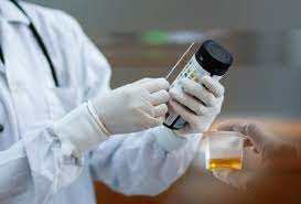 But its reading way different from my other hanna. Urine Ph Normal Ranges And What They Mean