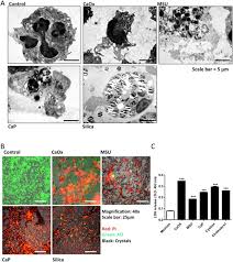 Workers, supervisors, inspectors.) and anyone with any questions or comments about asbestos and other environmental issues and concerns. Particles Of Different Sizes And Shapes Induce Neutrophil Necroptosis Followed By The Release Of Neutrophil Extracellular Trap Like Chromatin Scientific Reports
