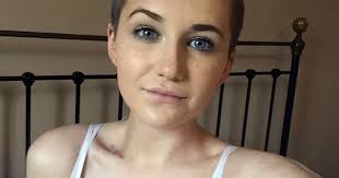 'Bald and proud': Cancer teenager who lost all her hair writes moving blog  about rollercoaster treatment