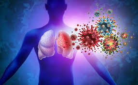 Image result for Pneumonia