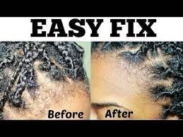 How To Easy Fix Hairline Edges Box Braids Twists Blonde Box Braids Natural Hair Styles Edges Hair