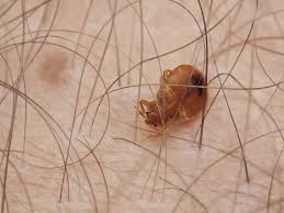Collection by crystal cat lover. Where Do Bed Bugs Hide Terminix