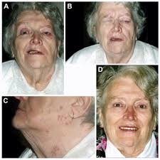 Weakness (Section 3)