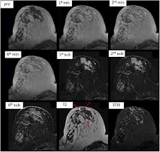 Communicate smoothly and use a free online translator to instantly translate words, phrases, or documents between 90+ language pairs. Does Higher Field Strength Translate Into Better Diagnostic Accuracy A Prospective Comparison Of Breast Mri At 3 And 1 5 Tesla European Journal Of Radiology