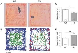 Discount prices and promotional sale on all receivers & amplifiers. Pathological Gamma Oscillations Impaired Dopamine Release Synapse Loss And Reduced Dynamic Range Of Unitary Glutamatergic Synaptic Transmission In The Striatum Of Hypokinetic Q175 Huntington Mice Sciencedirect