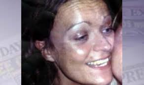 Blast survivor's baby due