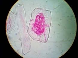 Image result for Centrostigma occultans